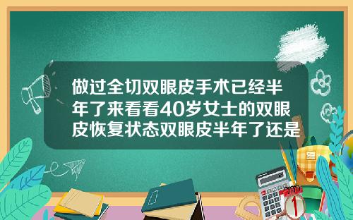 做过全切双眼皮手术已经半年了来看看40岁女士的双眼皮恢复状态双眼皮半年了还是肿的怎么办