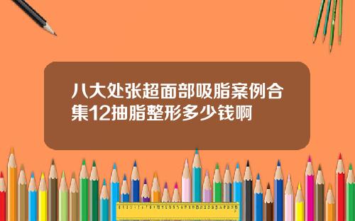 八大处张超面部吸脂案例合集12抽脂整形多少钱啊