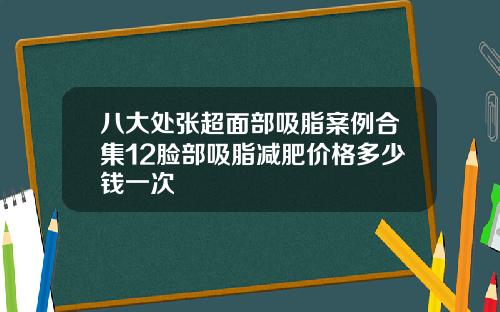 八大处张超面部吸脂案例合集12脸部吸脂减肥价格多少钱一次