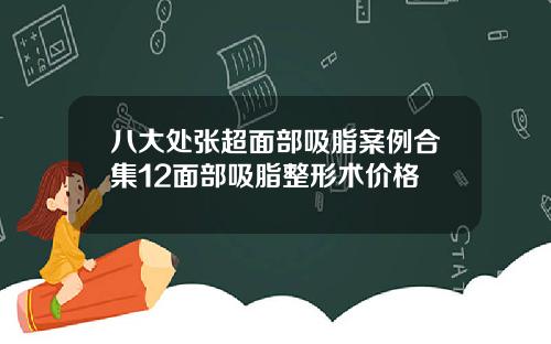 八大处张超面部吸脂案例合集12面部吸脂整形术价格