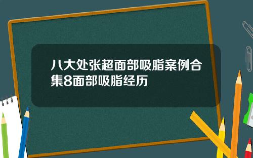 八大处张超面部吸脂案例合集8面部吸脂经历