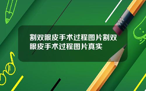 割双眼皮手术过程图片割双眼皮手术过程图片真实