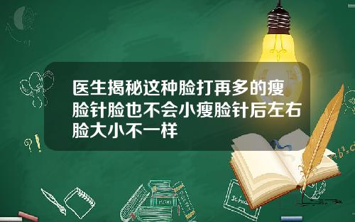 医生揭秘这种脸打再多的瘦脸针脸也不会小瘦脸针后左右脸大小不一样