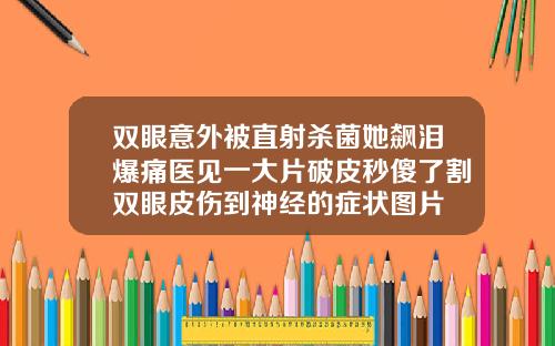 双眼意外被直射杀菌她飙泪爆痛医见一大片破皮秒傻了割双眼皮伤到神经的症状图片