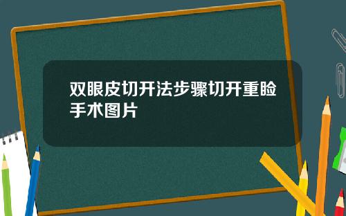 双眼皮切开法步骤切开重睑手术图片