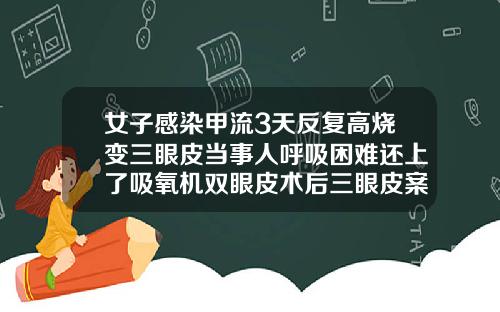 女子感染甲流3天反复高烧变三眼皮当事人呼吸困难还上了吸氧机双眼皮术后三眼皮案例