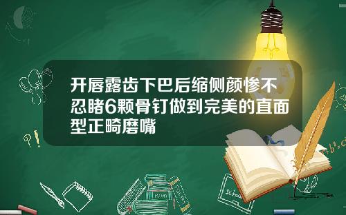 开唇露齿下巴后缩侧颜惨不忍睹6颗骨钉做到完美的直面型正畸磨嘴