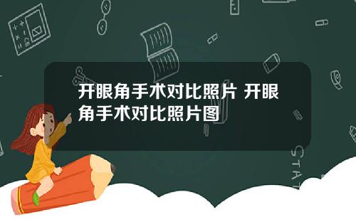 开眼角手术对比照片 开眼角手术对比照片图