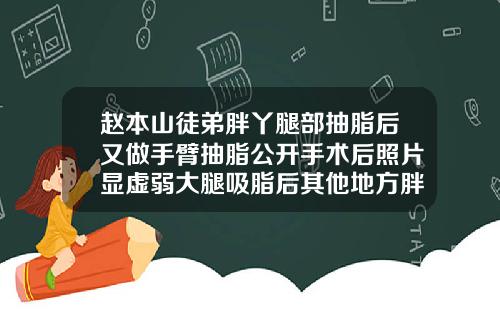 赵本山徒弟胖丫腿部抽脂后又做手臂抽脂公开手术后照片显虚弱大腿吸脂后其他地方胖了