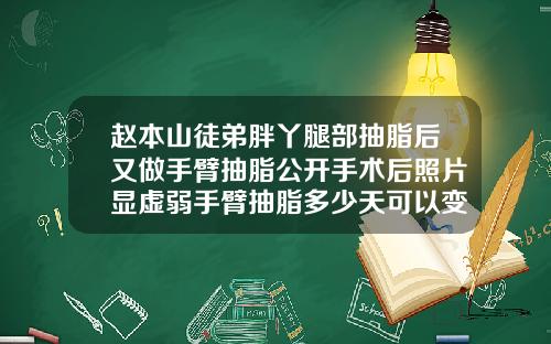 赵本山徒弟胖丫腿部抽脂后又做手臂抽脂公开手术后照片显虚弱手臂抽脂多少天可以变细