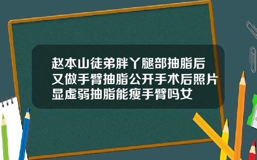 赵本山徒弟胖丫腿部抽脂后又做手臂抽脂公开手术后照片显虚弱抽脂能瘦手臂吗女