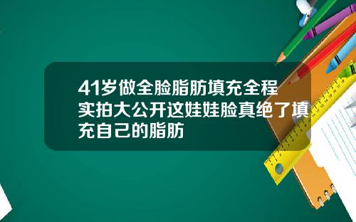 41岁做全脸脂肪填充全程实拍大公开这娃娃脸真绝了填充自己的脂肪