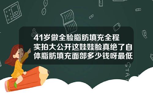 41岁做全脸脂肪填充全程实拍大公开这娃娃脸真绝了自体脂肪填充面部多少钱呀最低