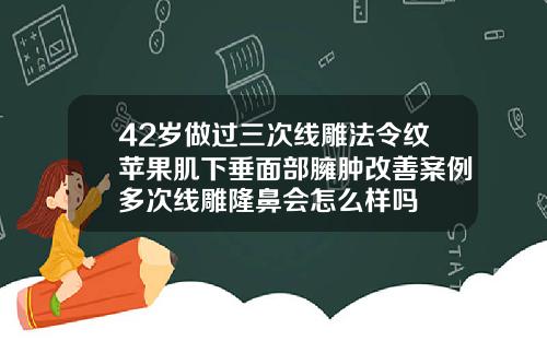 42岁做过三次线雕法令纹苹果肌下垂面部臃肿改善案例多次线雕隆鼻会怎么样吗