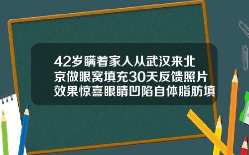 42岁瞒着家人从武汉来北京做眼窝填充30天反馈照片效果惊喜眼睛凹陷自体脂肪填充能维持多久