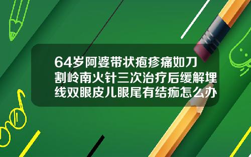 64岁阿婆带状疱疹痛如刀割岭南火针三次治疗后缓解埋线双眼皮儿眼尾有结痂怎么办图片