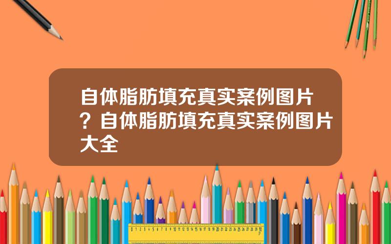 自体脂肪填充真实案例图片？自体脂肪填充真实案例图片大全